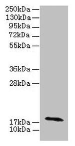 RPP21 Polyclonal Antibody