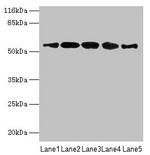 VIPAS39 Antibody in Western Blot (WB)