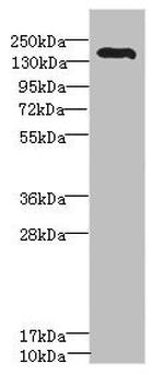 ROBO2 Polyclonal Antibody