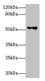 PNPLA3 Antibody in Western Blot (WB)