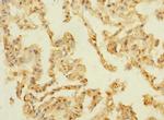 mPR gamma Antibody in Immunohistochemistry (Paraffin) (IHC (P))