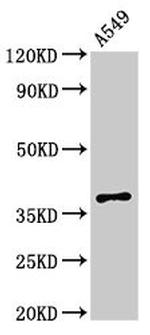mPR gamma Antibody in Western Blot (WB)