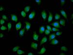 NEDL2 Polyclonal Antibody