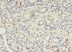 MTRR Polyclonal Antibody