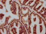 FBXO10 Antibody in Immunohistochemistry (Paraffin) (IHC (P))