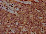 FBXO10 Antibody in Immunohistochemistry (Paraffin) (IHC (P))
