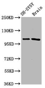 FBXO10 Antibody in Western Blot (WB)