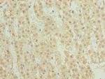 TRMT6 Polyclonal Antibody