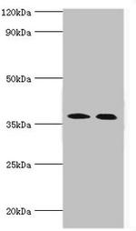 CA14 Antibody in Western Blot (WB)