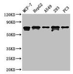 MAGED2 Antibody in Western Blot (WB)