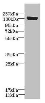 SCN8A Antibody in Western Blot (WB)