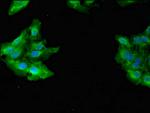 GAB2 Polyclonal Antibody