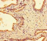 PPM1H Antibody in Immunohistochemistry (Paraffin) (IHC (P))