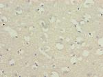 C3orf18 Antibody in Immunohistochemistry (Paraffin) (IHC (P))