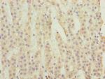 C3orf18 Antibody in Immunohistochemistry (Paraffin) (IHC (P))