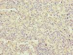 FBXL5 Polyclonal Antibody