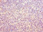 ORC6 Polyclonal Antibody
