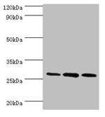 ORC6 Antibody in Western Blot (WB)