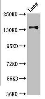 MAN2B2 Antibody in Western Blot (WB)