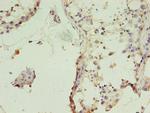 TIMM10B Antibody in Immunohistochemistry (Paraffin) (IHC (P))