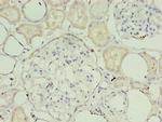 TIMM10B Polyclonal Antibody