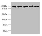 MORC2 Antibody in Western Blot (WB)