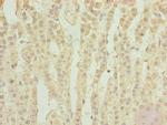 TPRKB Polyclonal Antibody
