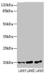 TPRKB Antibody in Western Blot (WB)