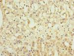 NME7 Polyclonal Antibody