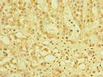 TZFP Polyclonal Antibody