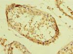 TZFP Antibody in Immunohistochemistry (Paraffin) (IHC (P))