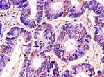 RTCB Antibody in Immunohistochemistry (Paraffin) (IHC (P))