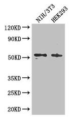 RTCB Antibody in Western Blot (WB)