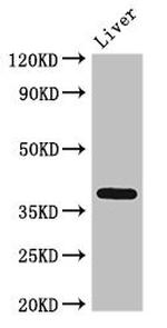 ETV7 Antibody in Western Blot (WB)