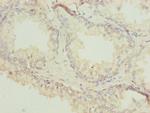 Actin-like 7B Polyclonal Antibody