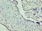 ORNT1 Polyclonal Antibody