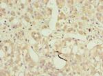 AP4B1 Polyclonal Antibody