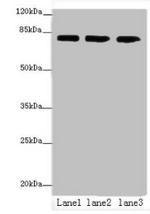 AP4B1 Antibody in Western Blot (WB)