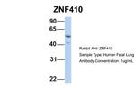 ZNF410 Antibody in Western Blot (WB)