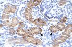 DMRTA2 Polyclonal Antibody