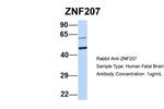 ZNF207 Polyclonal Antibody