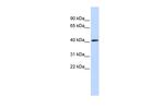PARP11 Polyclonal Antibody