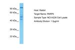 PARP9 Polyclonal Antibody