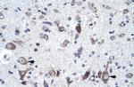 NCS1 Polyclonal Antibody