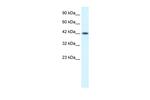 YBX1 Polyclonal Antibody