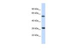 RNF3 Polyclonal Antibody