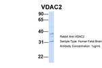 VDAC2 Antibody in Western Blot (WB)