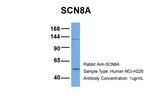 SCN8A Polyclonal Antibody