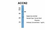 ASIC1 Polyclonal Antibody