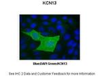 KCNK13 Polyclonal Antibody